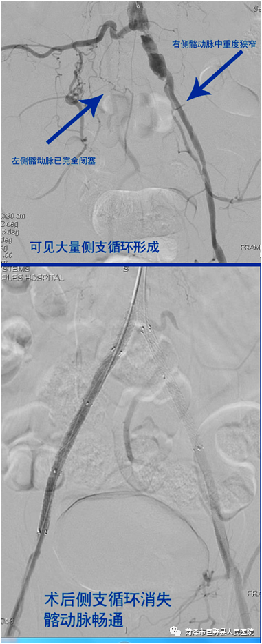 同一首歌歌词